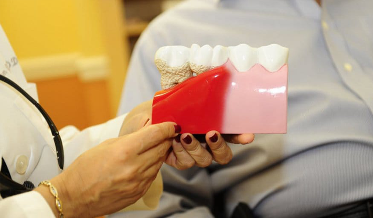 Why should you visit the gum disease treatment center?