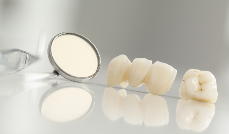 Dental Restoration, A way to Restore Your Tooth