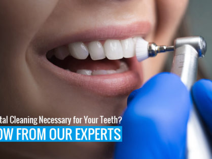 Is Dental Cleaning Necessary for Your Teeth? Know from Our Experts