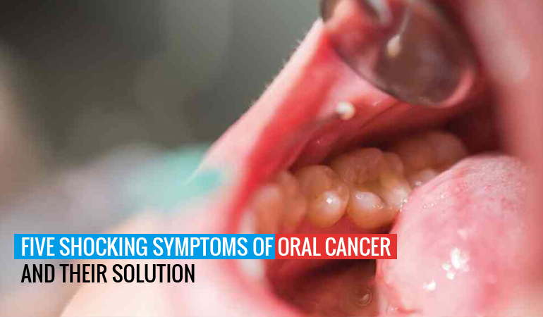 Five Shocking Symptoms of Oral Cancer and Their Solution