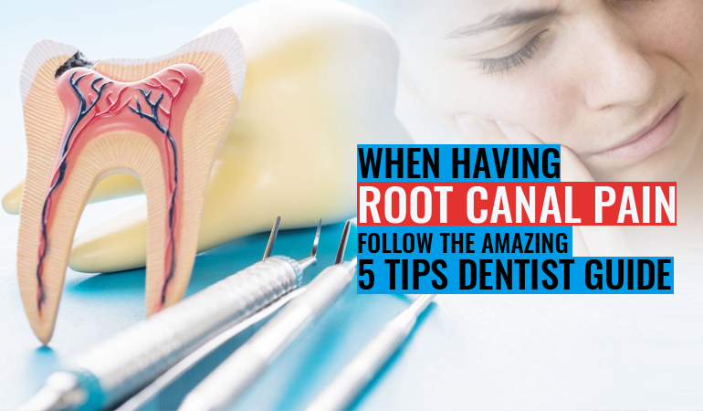 When Having Root Canal Pain, Follow The Amazing 5 Tips - Dentist Guide