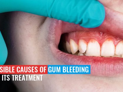 Possible Causes Of Gum Bleeding And Its Treatment
