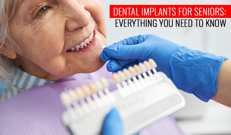 Dental Implants for Seniors: Everything You Need to Know