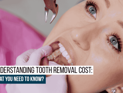 Understanding Tooth Removal Cost: What You Need to Know?