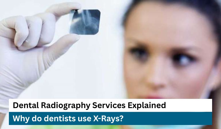 Dental Radiography Services Explained: Types, Uses, and Benefits