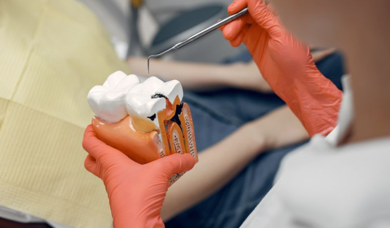 Tooth Restorations: How Can They Bring Your Smile Back?