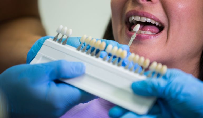 implant-cosmetic-dentistry