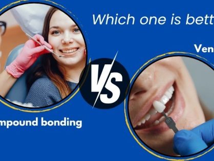 Veneers vs Bonding: Which Cosmetic Dental Option Is Best?