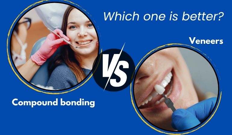 Veneers vs Bonding: Which Cosmetic Dental Option Is Best?