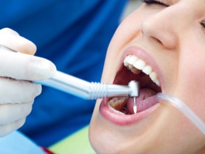 Why Patients Trust Professional Dental Restoration Services in Davie