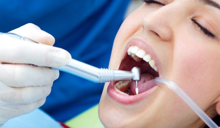 Why Patients Trust Professional Dental Restoration Services in Davie