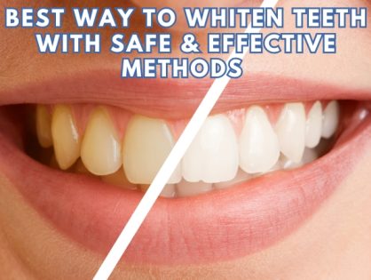 What Is the Best Way to Whiten Teeth? Safe & Effective Methods Explained