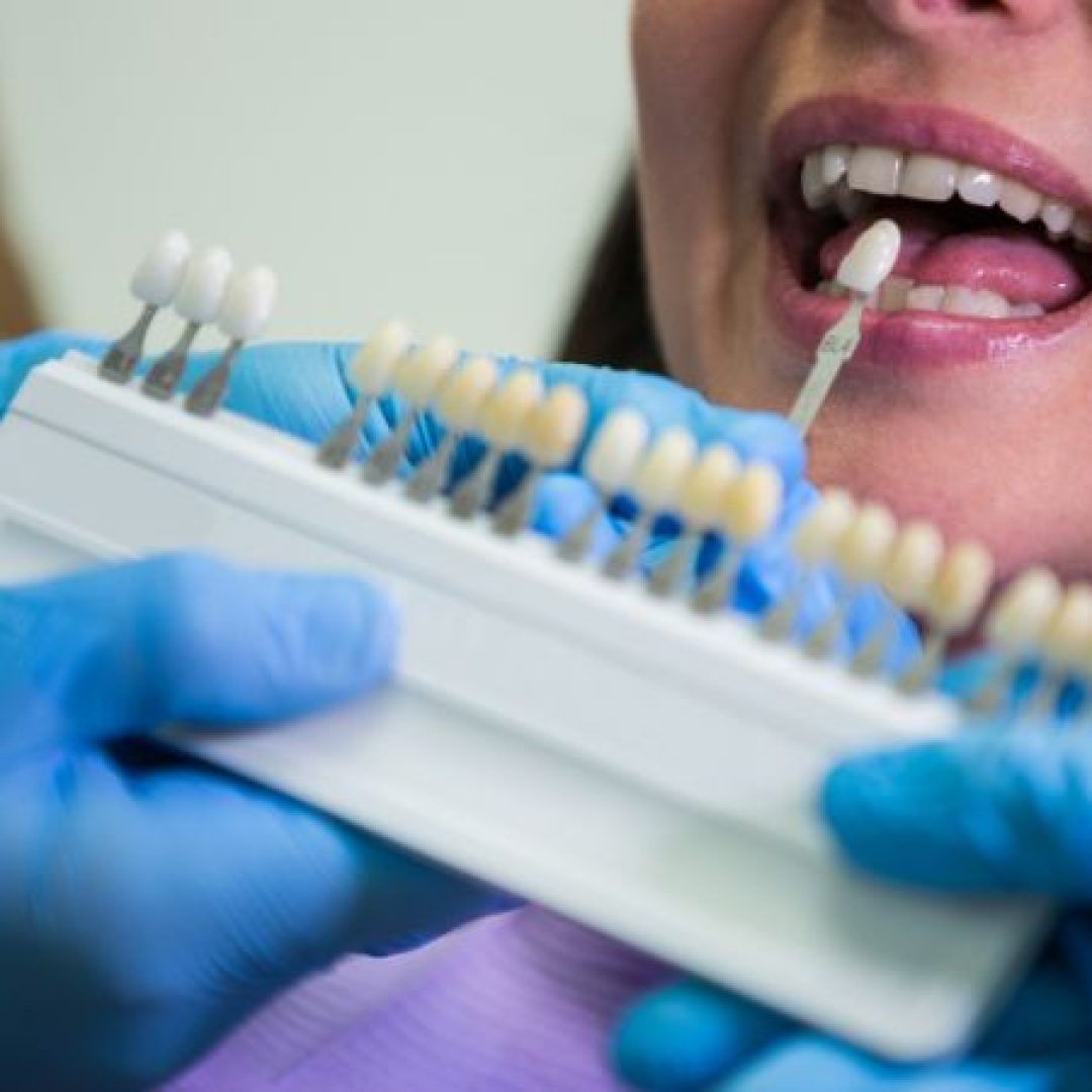 implant-cosmetic-dentistry