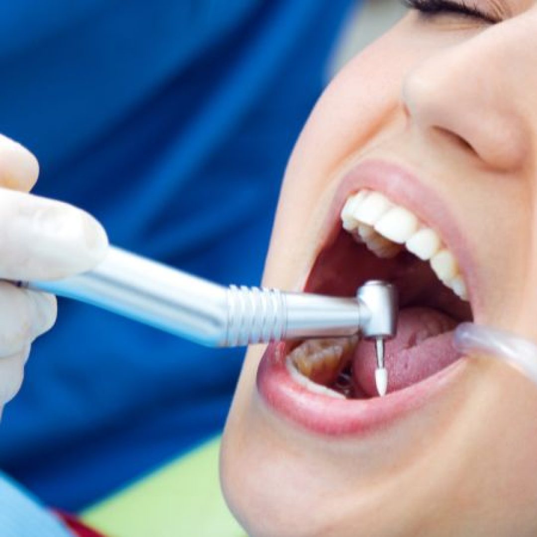 root-canal-treatment